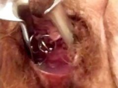 Speculum removal push, see deep inside mature MILF BBW gynecology medical